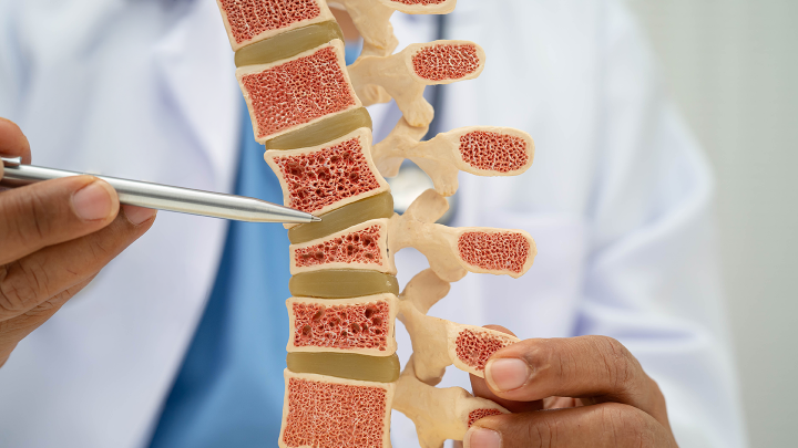Osteoporosis and Bone Health: What You Should Know