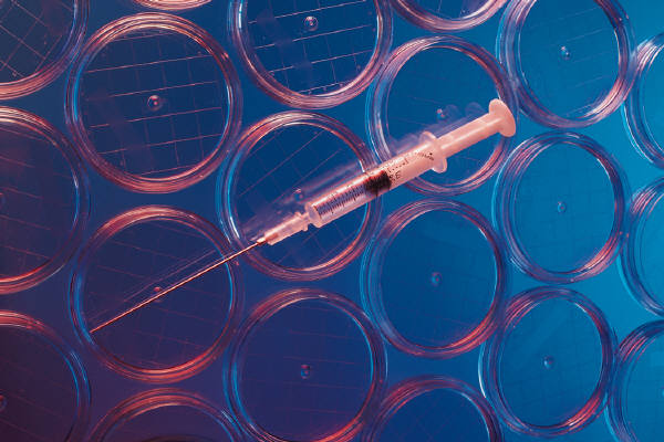 Autism in a Petri Dish