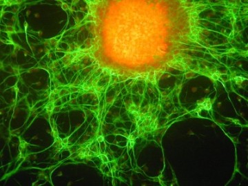 Cancerous Gene Crucial in Stem Cell Development