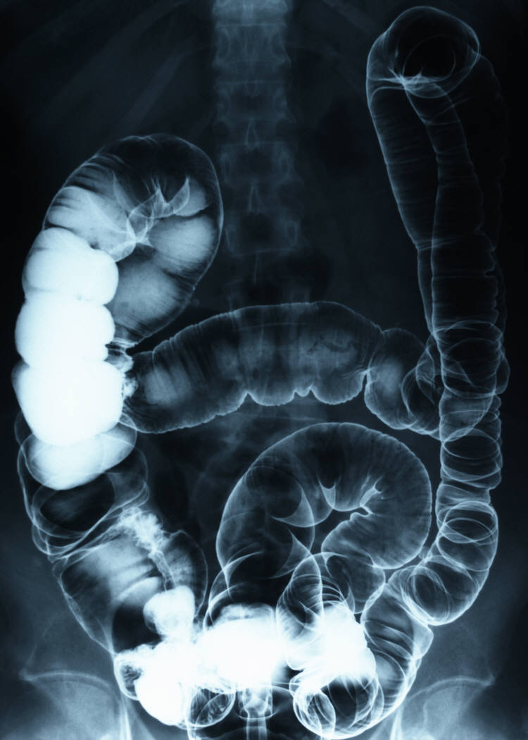 Forging New Paths