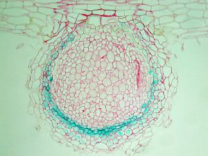 Statins Linked to Lower Stomach Cancer Risk