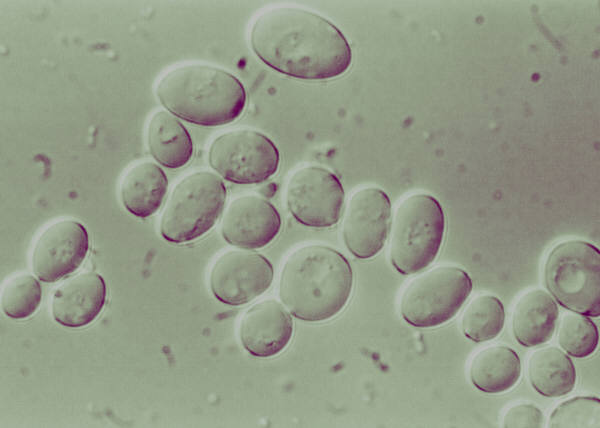 Leukemia Culprit Cornered