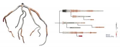 Visualizing Heart Disease