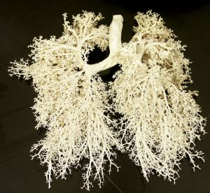 Blood Test Hopes to Detect Early Lung Cancer