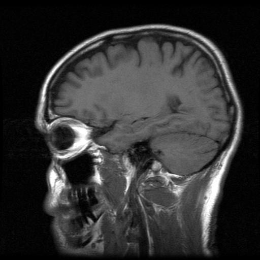 Rebels With A Cause of Grey Brain Matter 