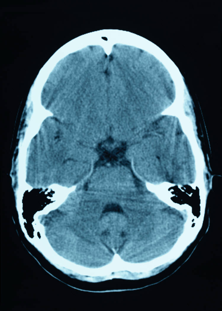 Skip the Test, Study Your Brain