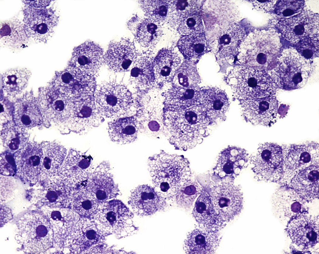 Researchers May Have Identified Root Cause of Parkinson's Disease