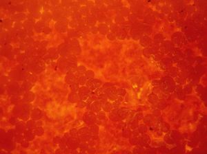 Using the Body's Natural Cancer Killers