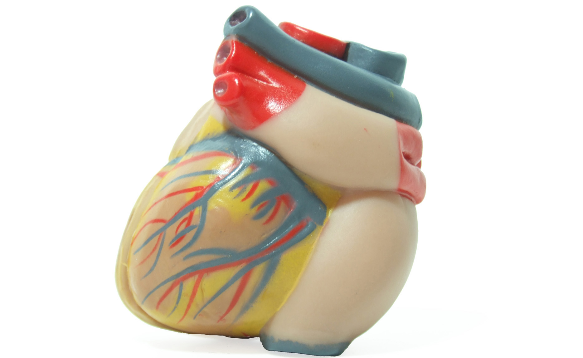 Reducing Heart Surgery Complications