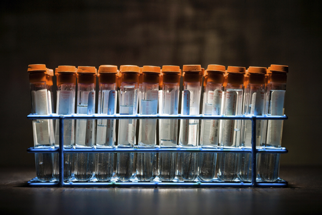 Scleroderma Commercial-Screening Method a Bust