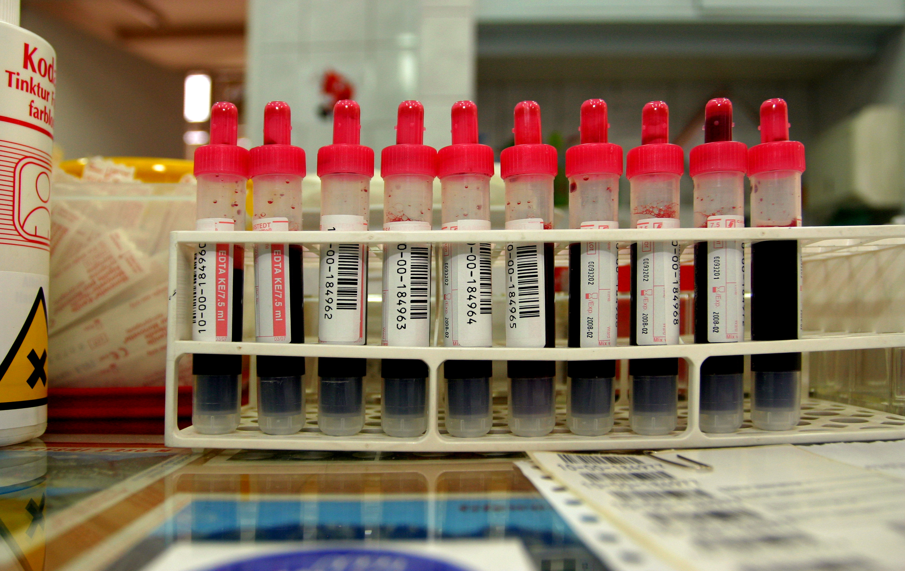 Too Many Cholesterol Tests?
