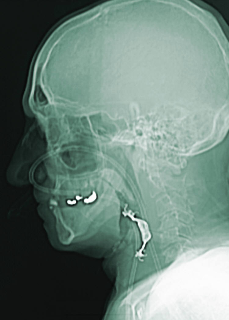 Early Diagnosis for Brain Disorders?
