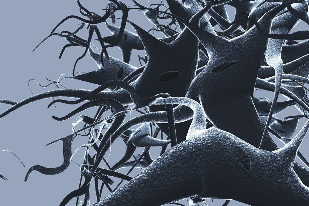 Is Your Neuron Firing Squad Doing Its Job?  