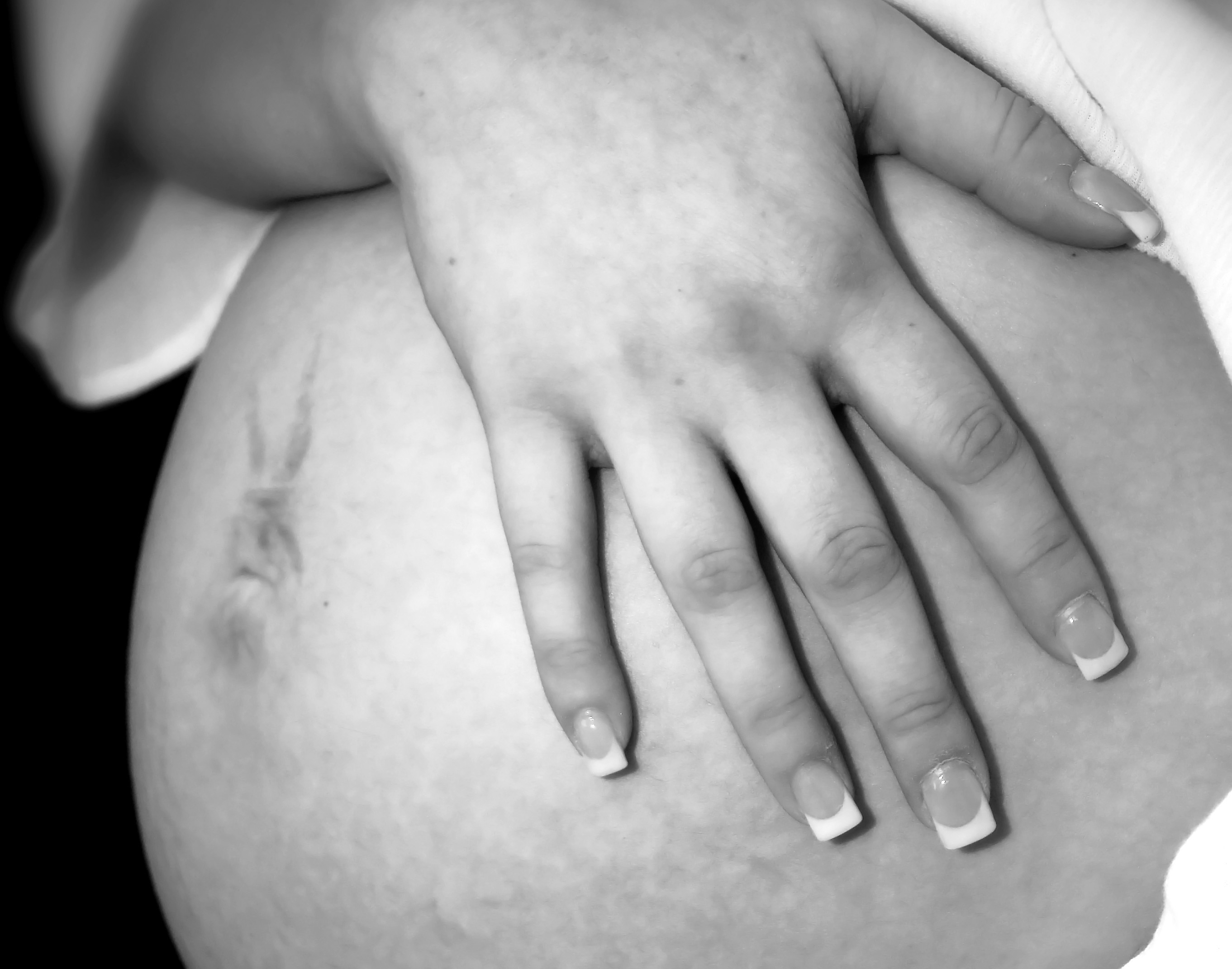 The Risk of Fighting Fungus During Pregnancy