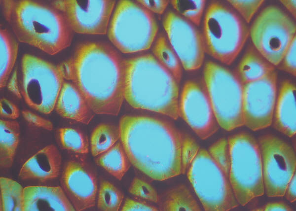 Prostate Cancer Cells Stopped in Their Tracks