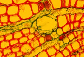 Reducing Colorectal Cancer Screening's Ouch