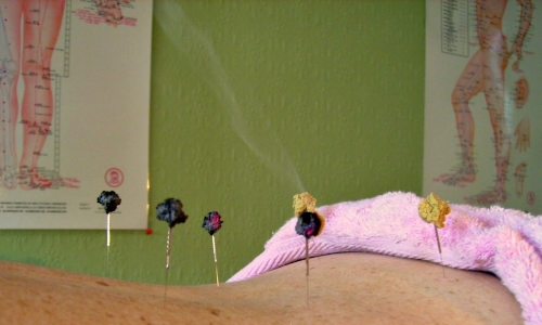 Alternative Medicine for Smoking