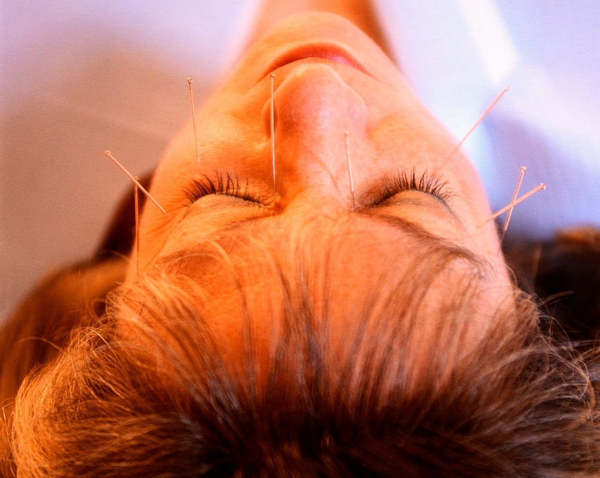 Why Does Acupuncture Work?