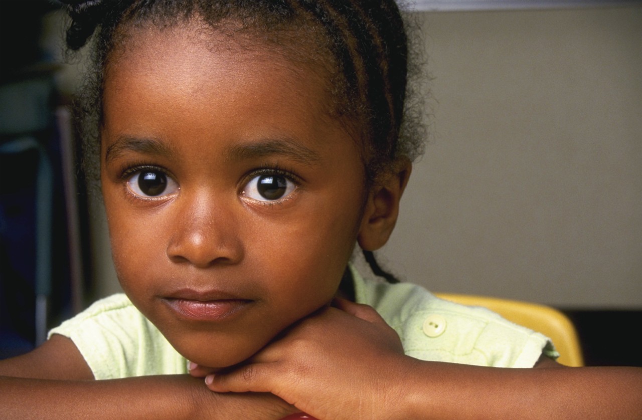 Signs of Allergy Differ by Race