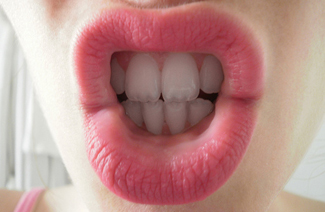 Spit Test Accurate for HIV Diagnosis