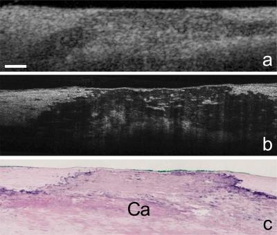 New Technology Reveals Coronary Artery Cells