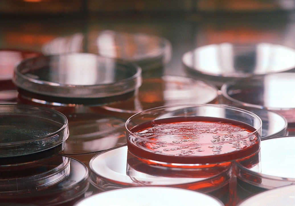 Bacteria Good For the Gut?