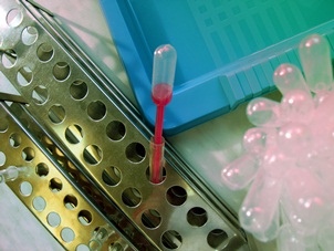 Blood Relatives of Breast Cancer
