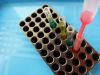 Detecting Breast Cancer Recurrence Earlier