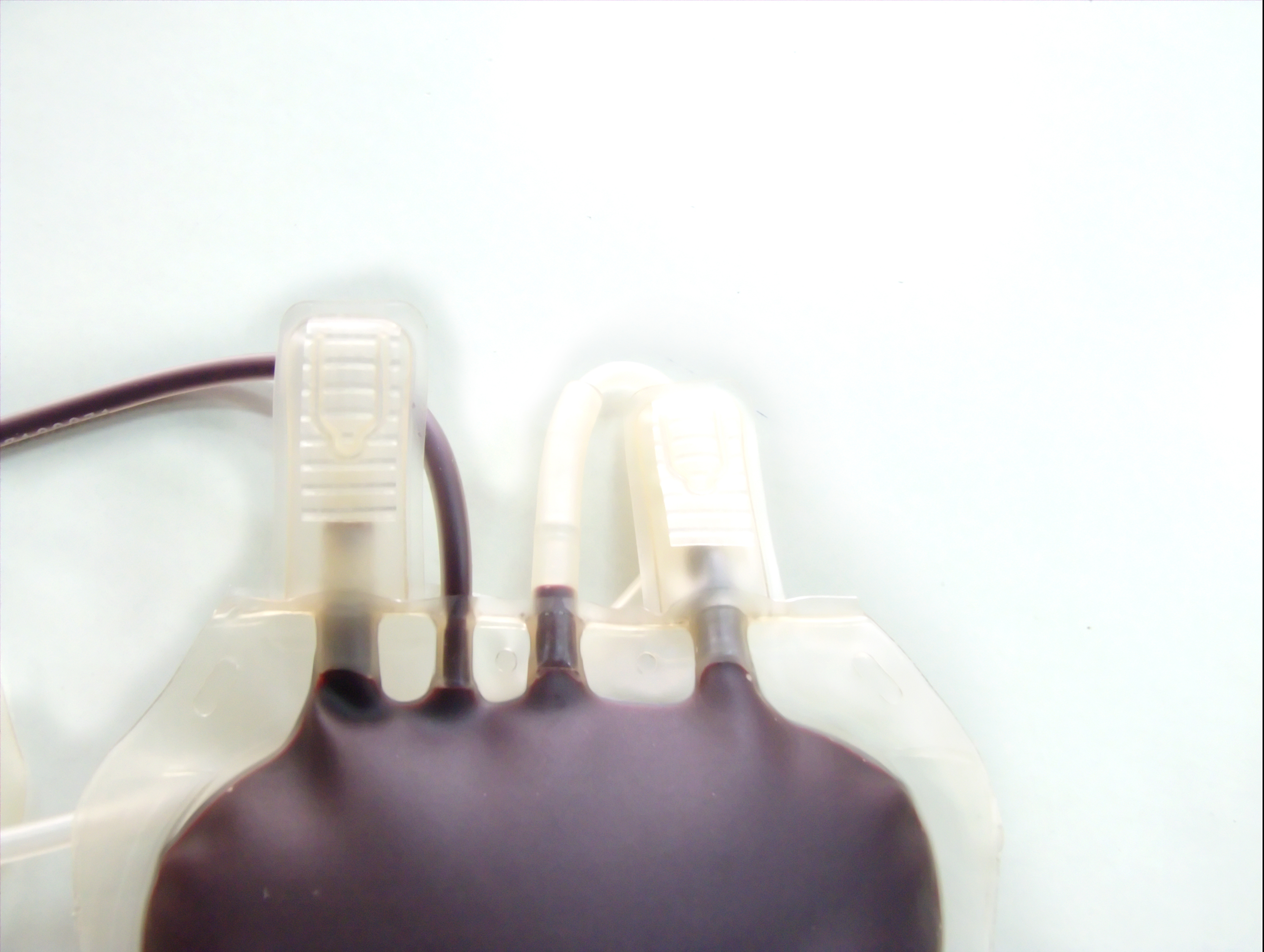 Fewer Blood Transfusions Needed After Surgery