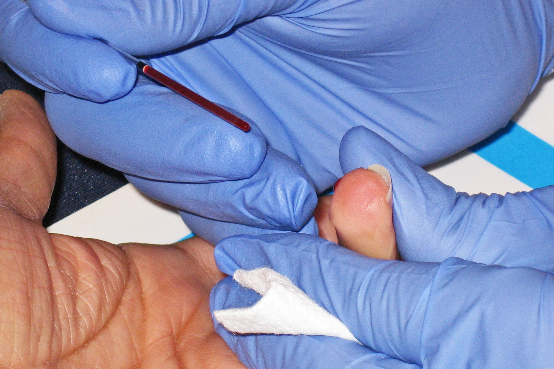 Heart Diagnostic Test Recalled