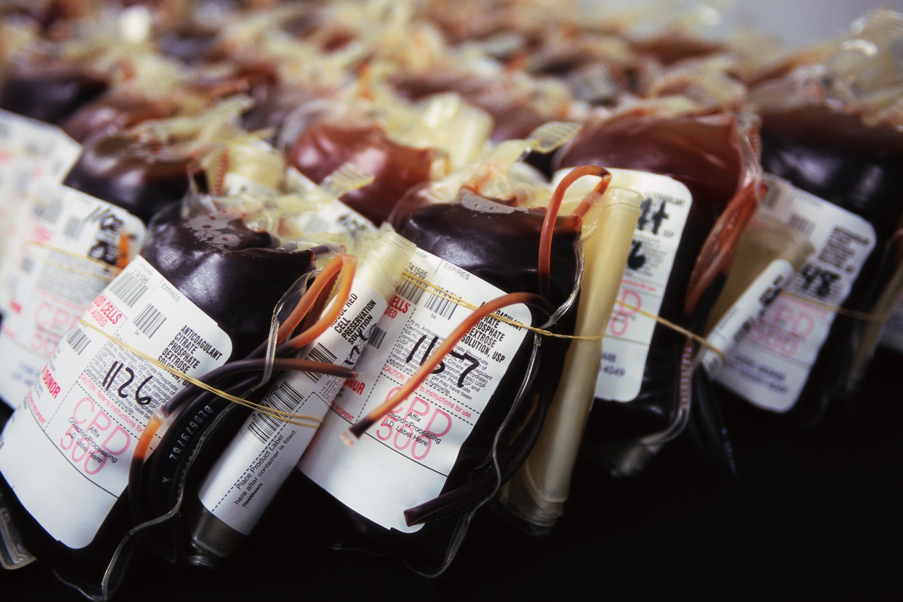 Safe to Stall Transfusions