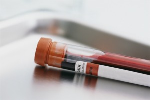 Many Cancer Patients Lacking in Vitamin D