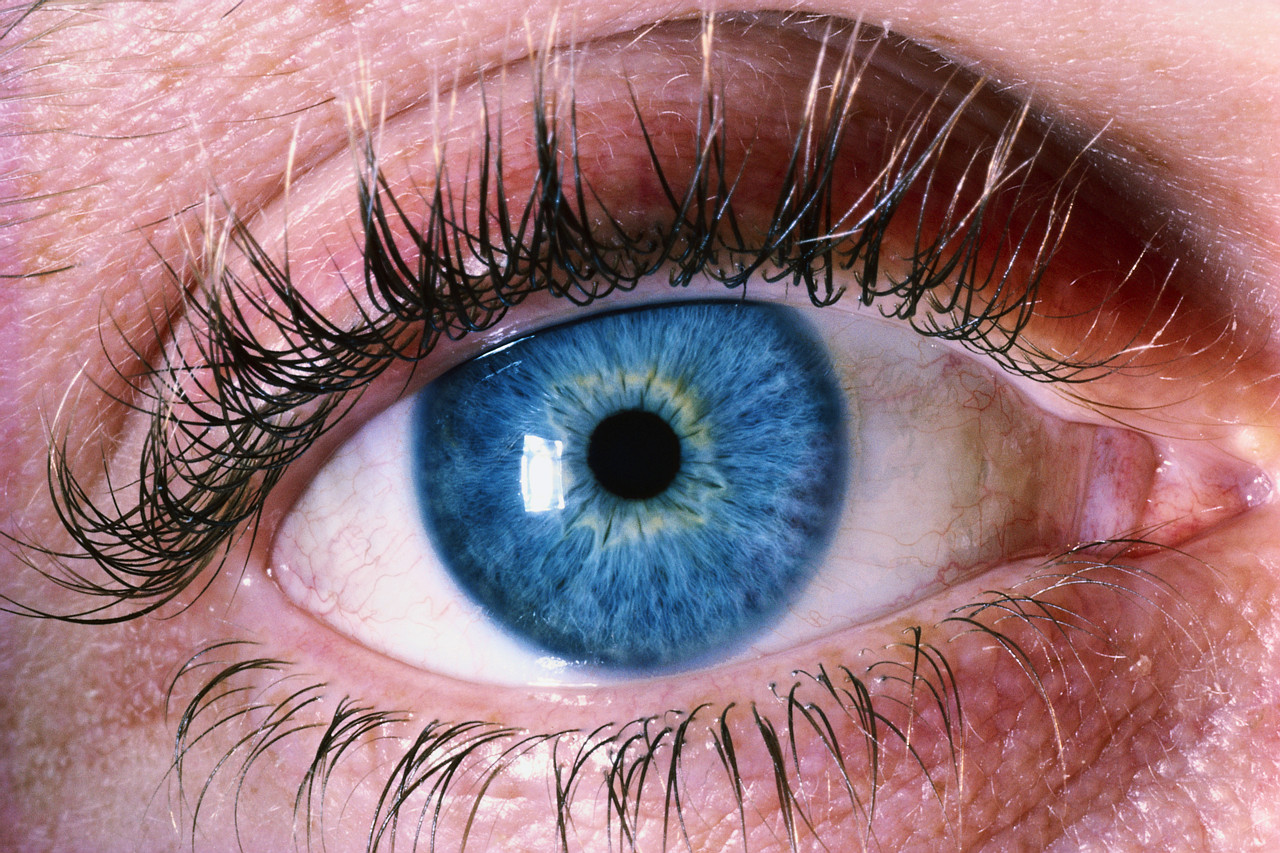Genetic Link to Blinding Eye Disease Found
