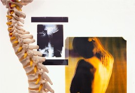 Boosting Bone Density and Extending Lives
