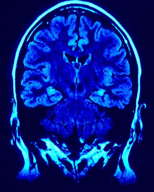 A Criminal Mind
