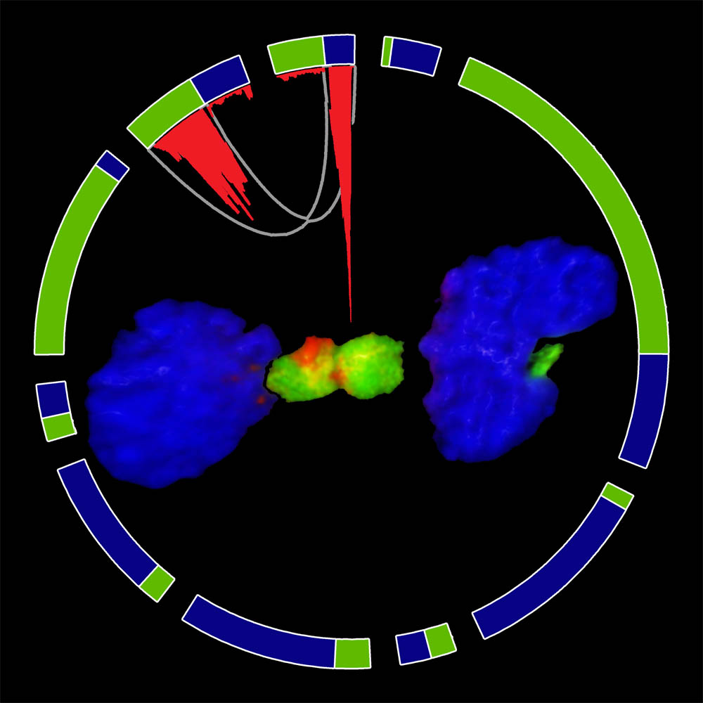 Genetic Fusion in Brain Cancer Discovered