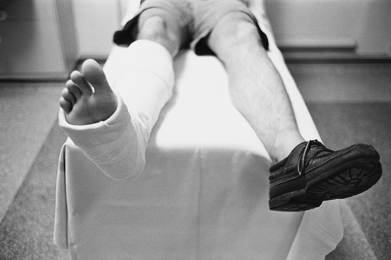 Diabetes Connected to Broken Bones