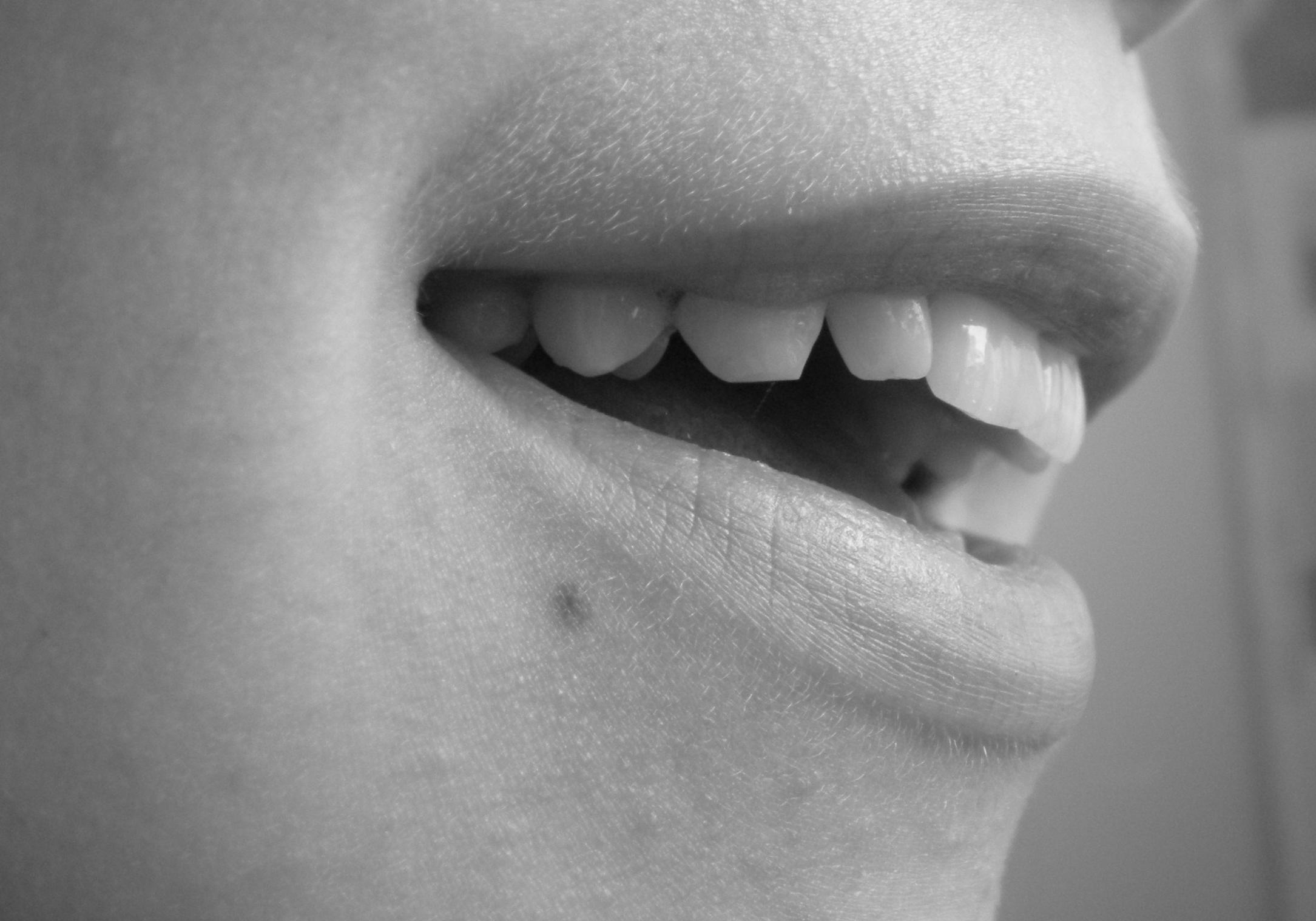 The Gapped Smile from Heavy Smoking