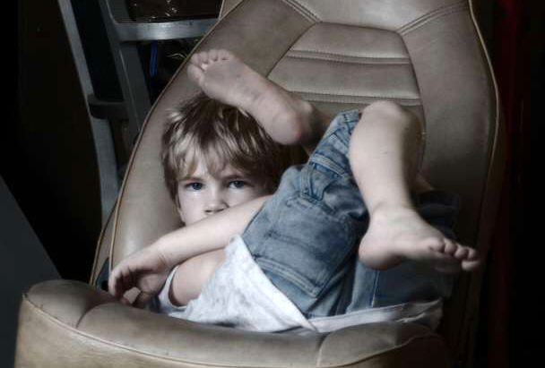 Battle Scars of Children who Beat Cancer