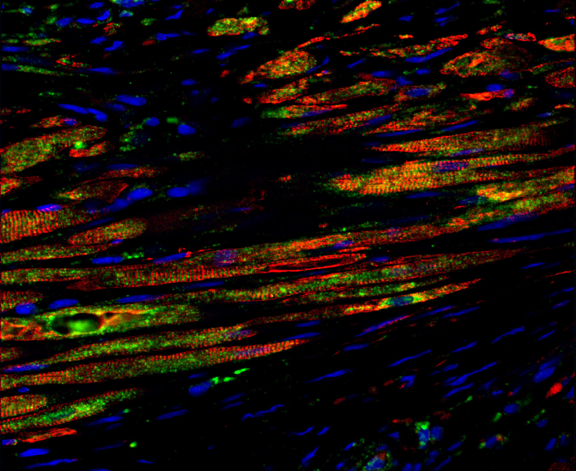 Stem Cells Rejuvenate Heart