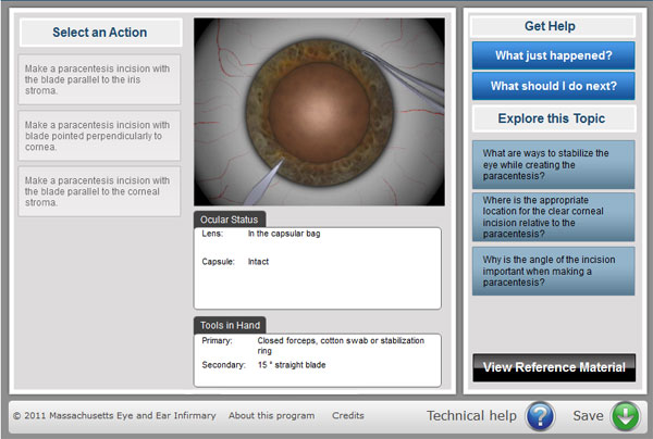 Teaching Tool Simulates Cataract Surgery