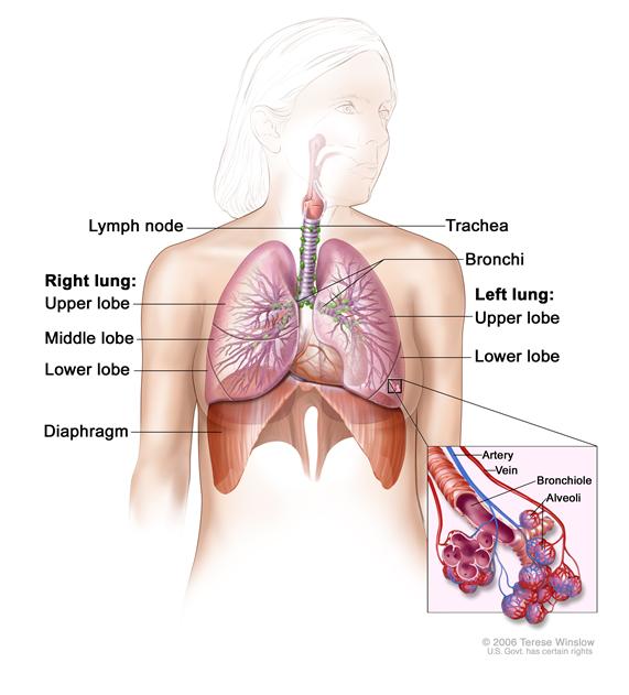 Pfizer Drug Receives Positive Opinion for Lung Cancer