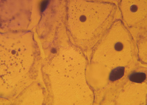Surprising Mechanism Aids Cell Self Destruction