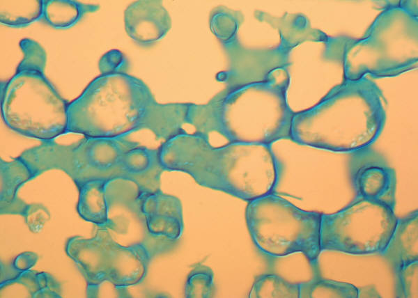New Ways to Fight E. Coli Infection