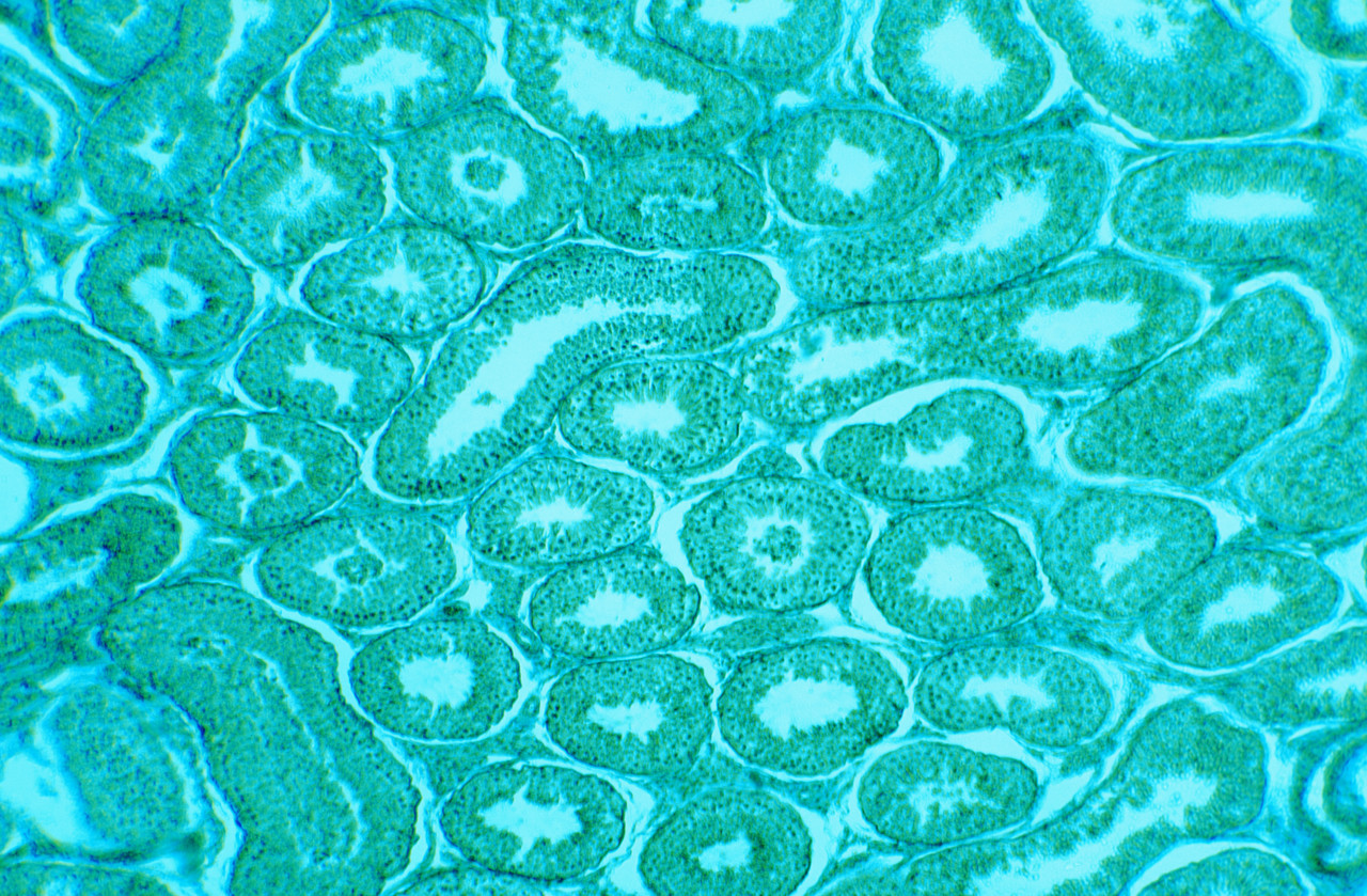 Treat Type 1 to Treat Hardened Arteries