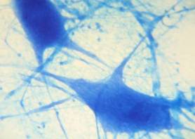 New Drug Therapy Shows Promise in Treating Leukemia