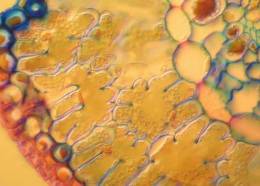 Cancer Cells' Diet Determines Aggressiveness