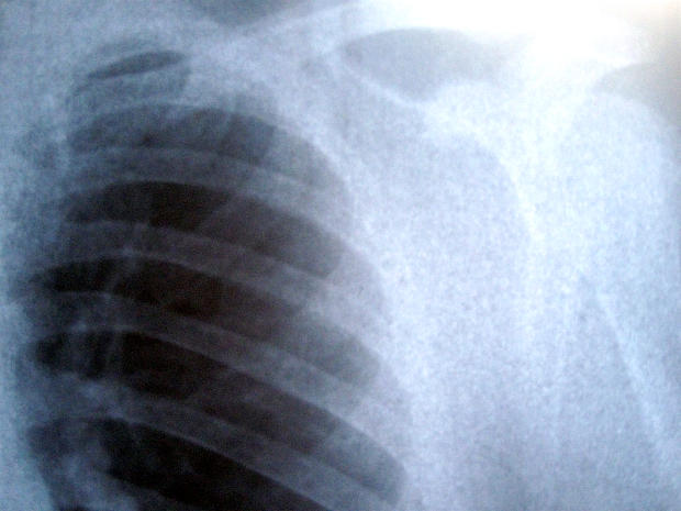 Why Cancer Drugs Stop Working