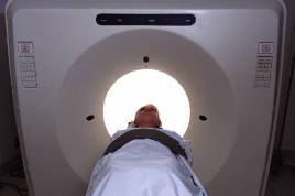 Developing Lung Cancer Screening Strategies