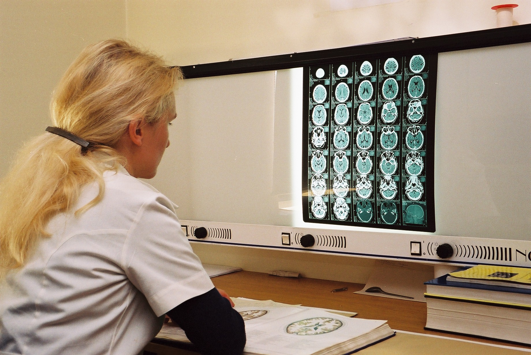 A Crystal Ball for Lung Cancer